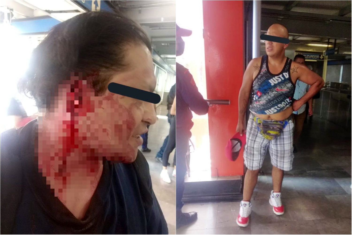 A lo Mike Tyson, sujeto le arranca la oreja a un usuario en el Metro Xola