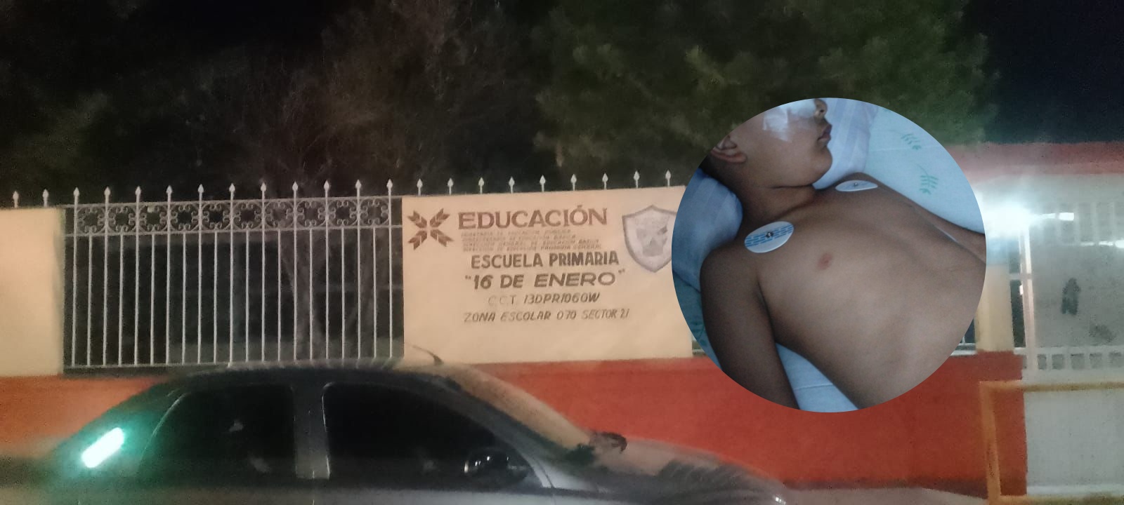 Recolectan recursos para alumno que podría perder ojo por agresión en escuela