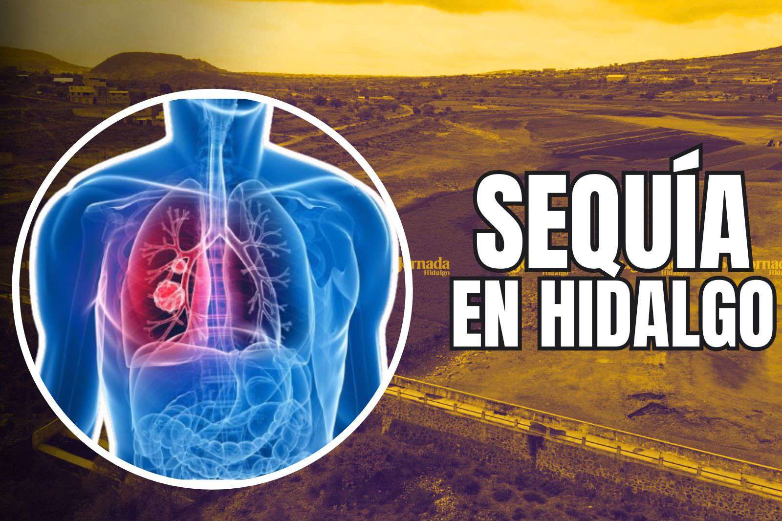 Sequía en Hidalgo agrava enfermedades respiratorias 