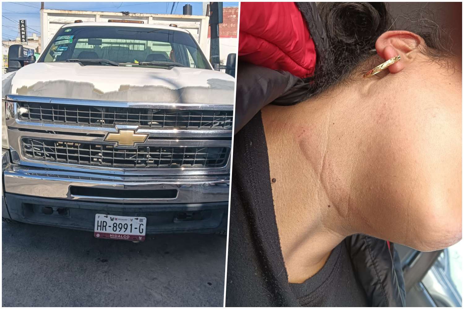 Pachuca: Gabriela del Villar pide atención médica tras accidente con camioneta de alcaldía