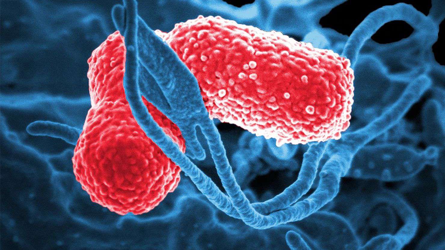 Bacteria Klebsiella Oxytoca: confirman seis bebés infectados en Guanajuato