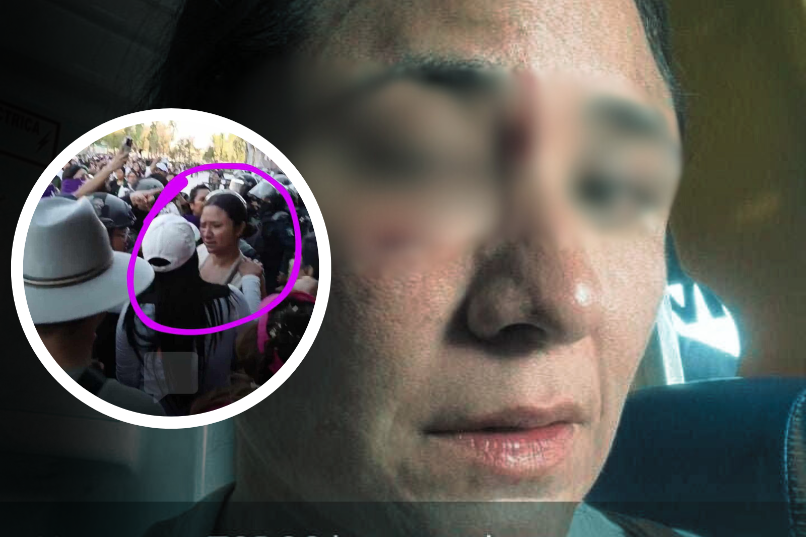 Mujer denuncia agresión policial en marcha del 8M en Pachuca