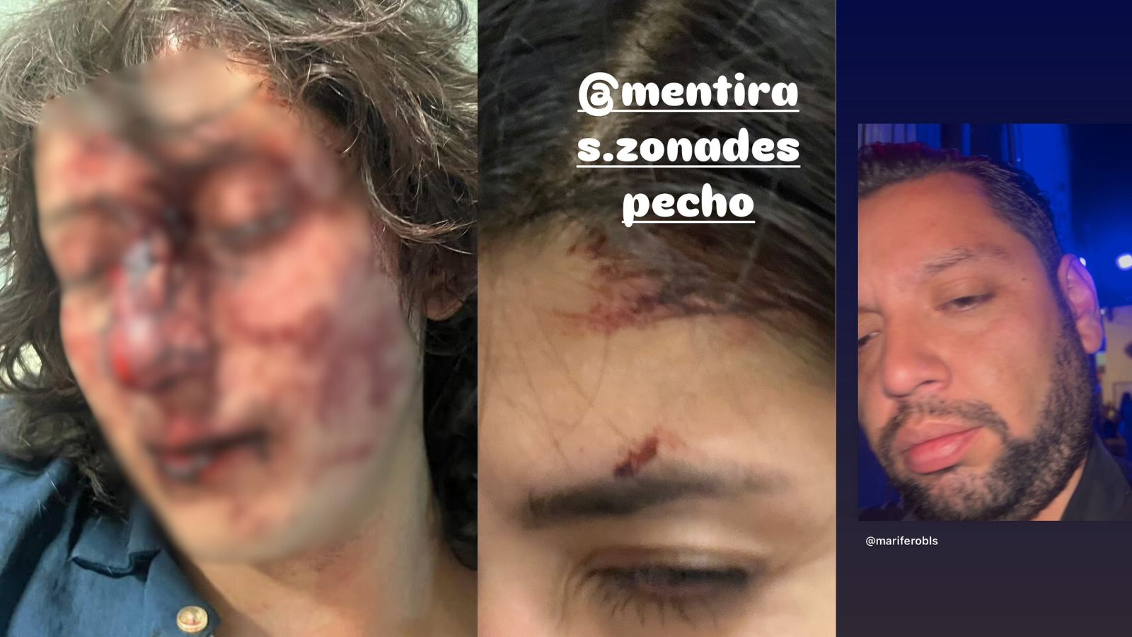 Denuncian brutal agresión en bar de Pachuca