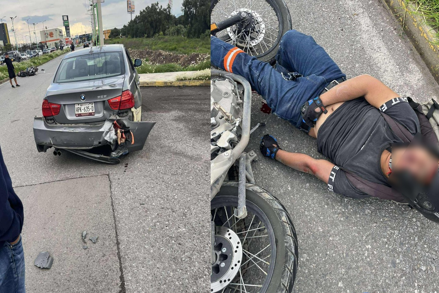 Motociclista pierde la pierna tras fuerte choque en Tizayuca
