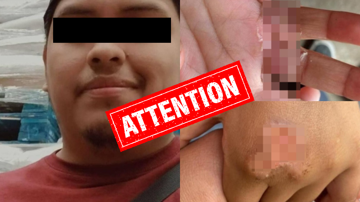 ¡Terrible! Queman manitas a niños de 4 y 6 años en Edomex; madre y padrastro actuaron en complicidad