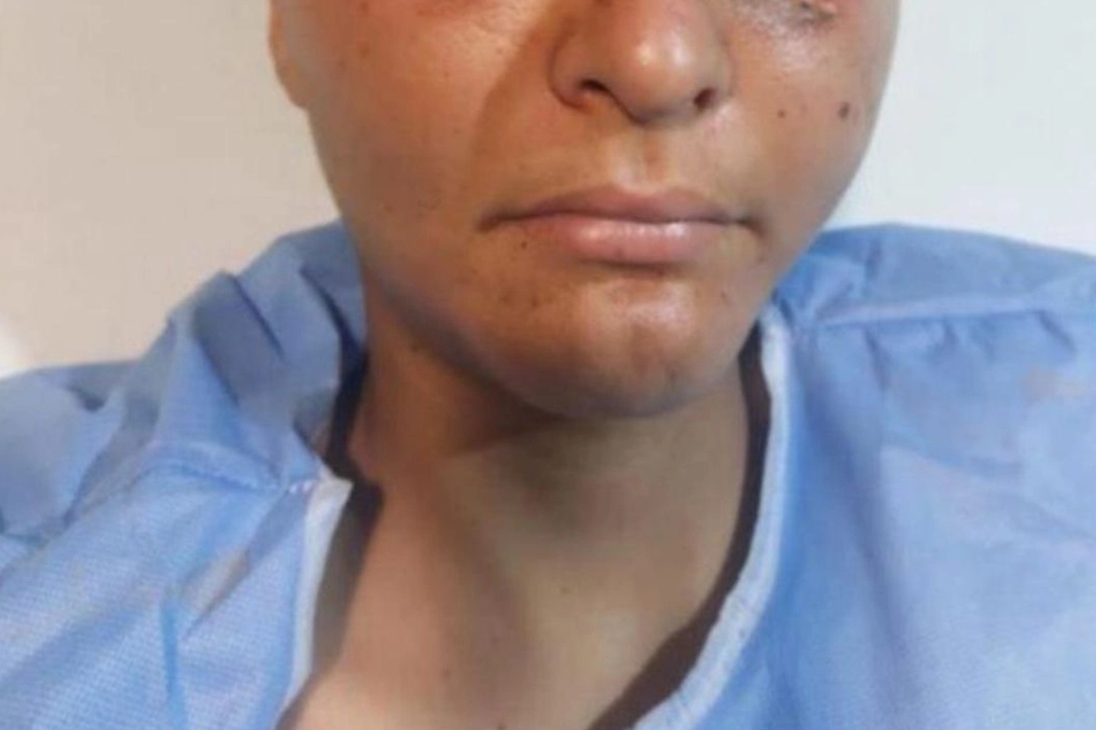 Joven pierde la vista debido a un proyecto escolar sin supervisar