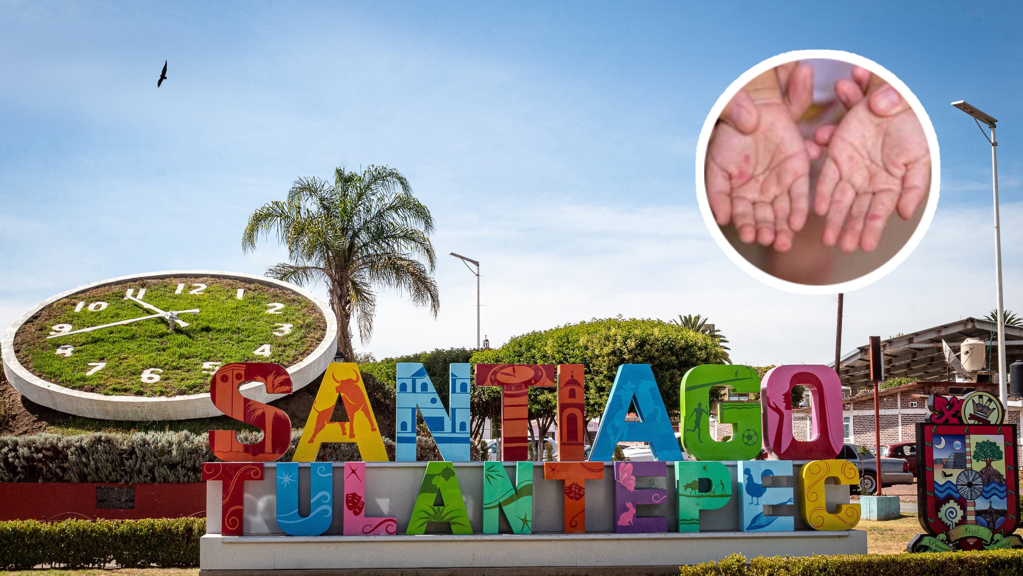 Santiago Tulantepec cancela desfile de la Revolución Mexicana por casos de sarampión