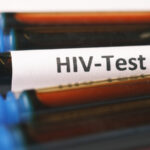 VIH test