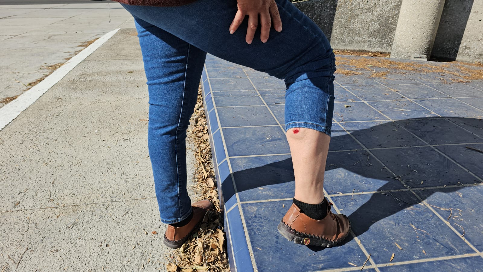 Periodista lesionada