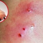 Detectan primer caso y activan protocolos en Hidalgo